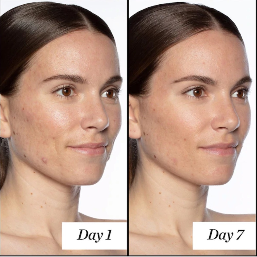 🌿SUNDAY RILEY Good Genes All-In-One Lactic Acid - Picture 7 of 11